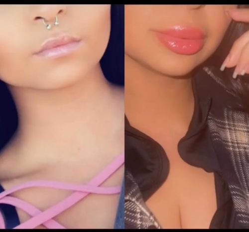 Dermalax Deep Plus photo review