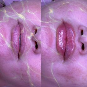 Celosome MID photo review