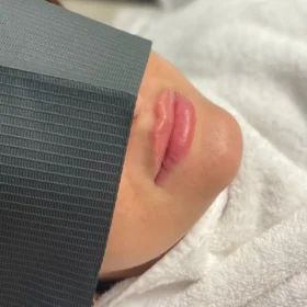 NEO-CAIN Cream 10.56% (500g) photo review