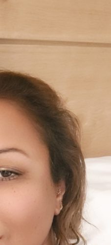 Replengen Volume photo review