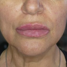 Revolax Deep photo review