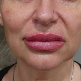 Revolax Deep photo review