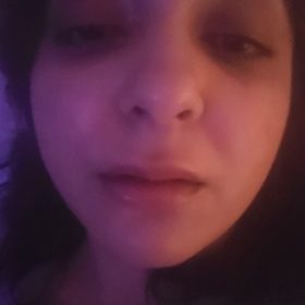 Neuramis Deep No Lidocaine photo review