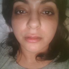 Neuramis Deep No Lidocaine photo review