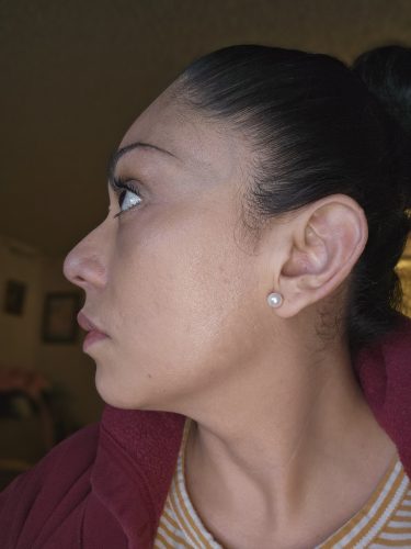 Celosome STRONG photo review