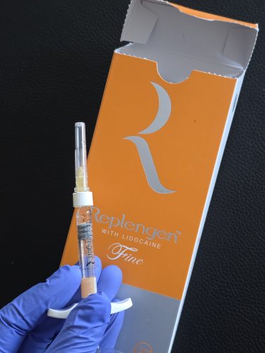 Replengen Fine photo review