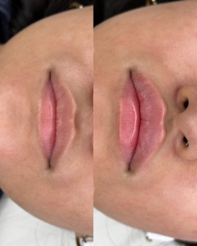 Revolax Deep photo review