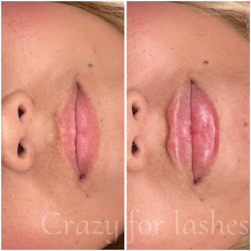 Celosome MID photo review