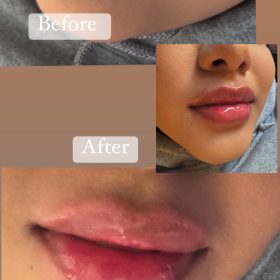 Celosome STRONG photo review