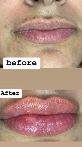 Celosome STRONG photo review