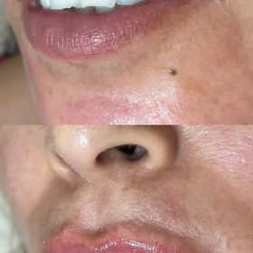 Celosome STRONG photo review