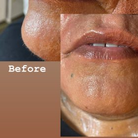 Celosome STRONG photo review