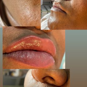 Celosome STRONG photo review