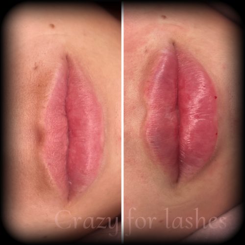 Celosome MID photo review