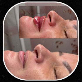 Celosome MID photo review