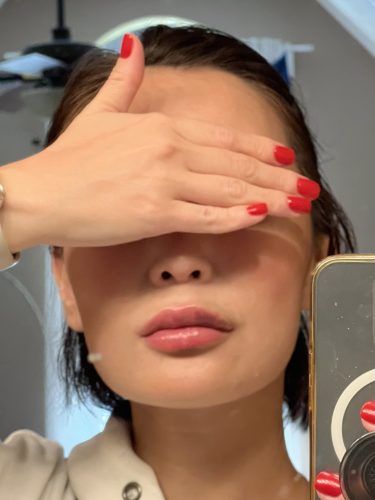 Rejeunesse Deep photo review