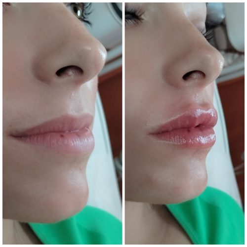 The Chaeum Premium #3 photo review