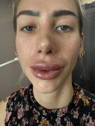 Revolax Deep photo review