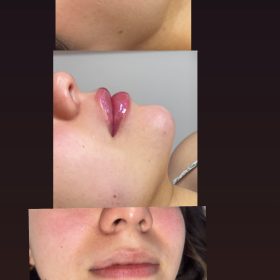 The Chaeum Premium #4 photo review