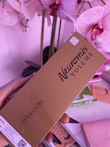 Neuramis Volume with Lidocaine photo review