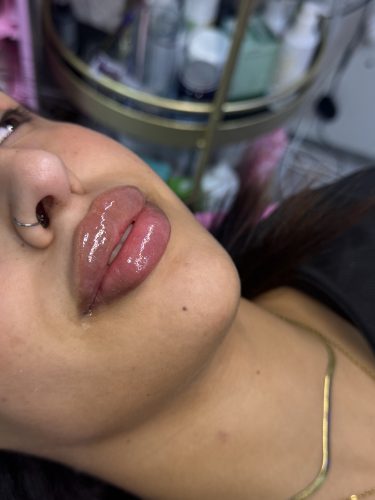 Rejeunesse Shape photo review