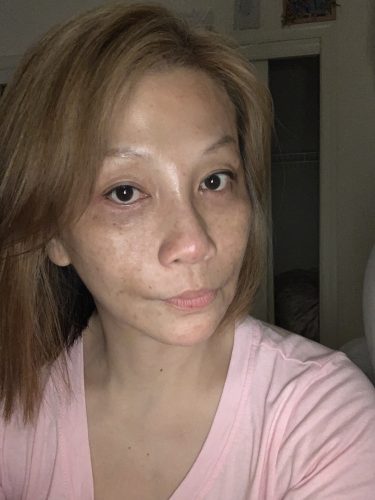 Rejeunesse Deep photo review