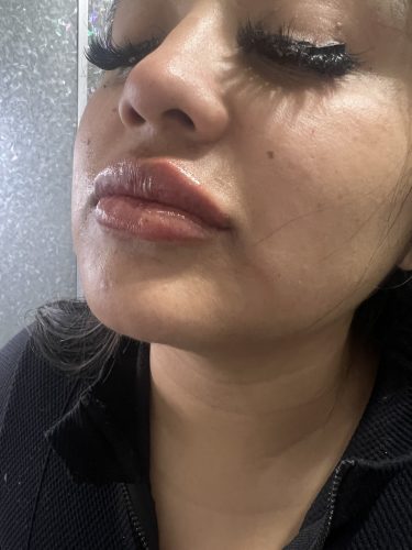 Rejeunesse Deep photo review