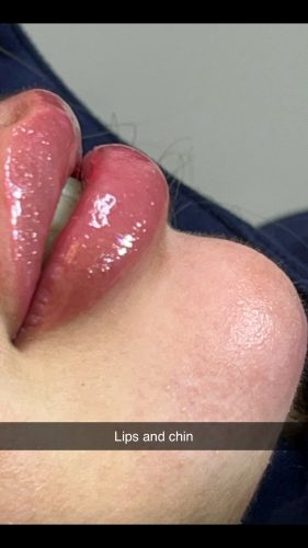 Celosome STRONG photo review