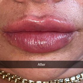 Sardenya Deep photo review