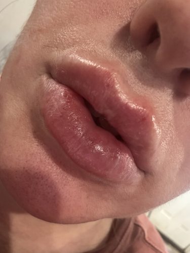 Celosome STRONG photo review