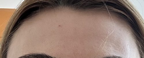 Rejeunesse Fine photo review