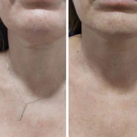 Kiara Reju photo review