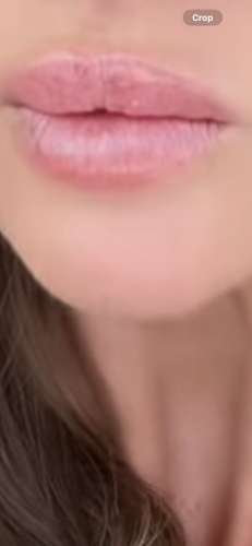 Rejeunesse Shape photo review