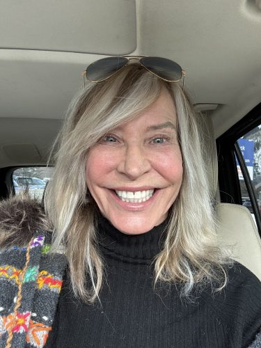 Neuramis Deep No Lidocaine photo review