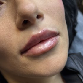 Revolax Deep photo review