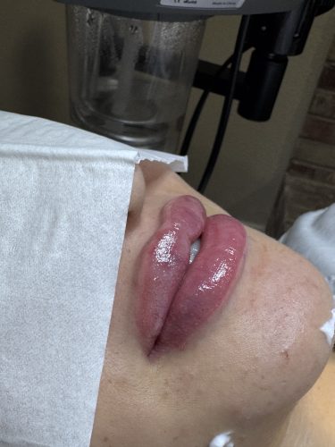 Revolax Deep photo review