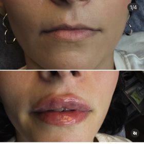 Revolax Deep photo review