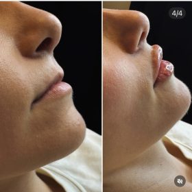 Revolax Deep photo review