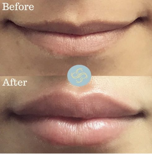 Celosome STRONG photo review