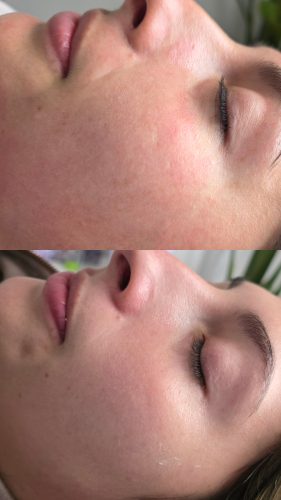 Curenex Rejuvenating Solution photo review