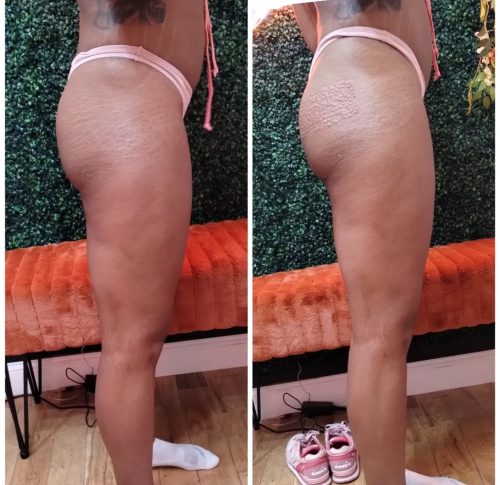 Sedy Fill Body Filler 60 ml photo review