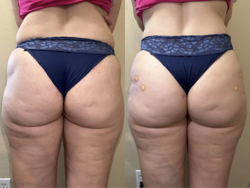 Wanna Fill 50 ml (HARD) photo review