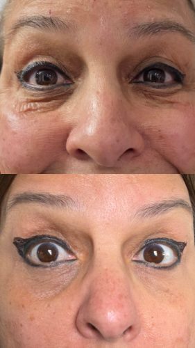 AMI eyes (PN) photo review