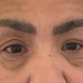 AMI eyes (PN) photo review