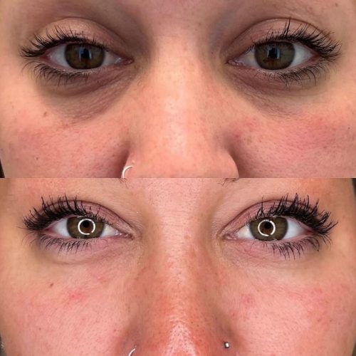 AMI eyes (PN) photo review