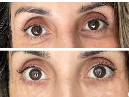 AMI eyes (PN) photo review