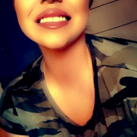 Innotox 50 Units (Exp: Dec 18, 2026) photo review