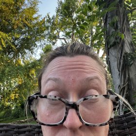 Innotox 100 Units photo review