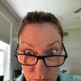 Innotox 100 Units photo review