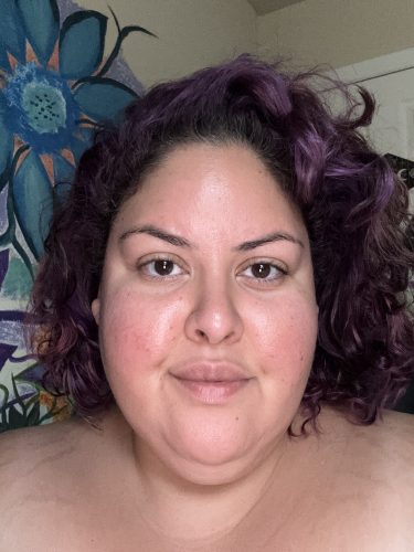 Innotox 100 Units photo review